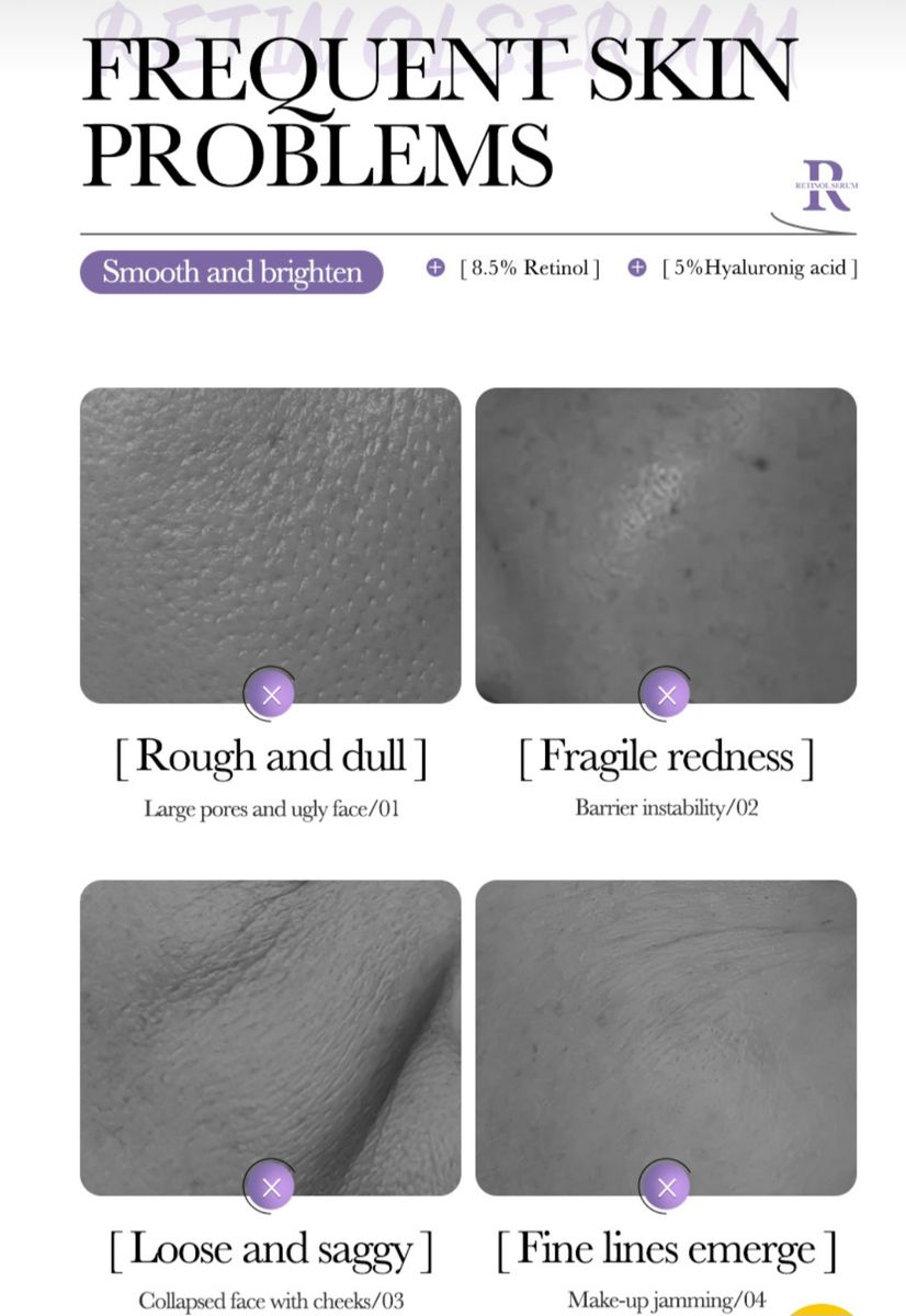 Retinol Facial Serum